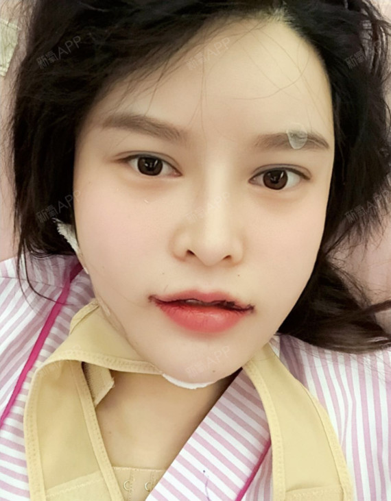 厨房里两只奶头被吸肿-第3张图片
