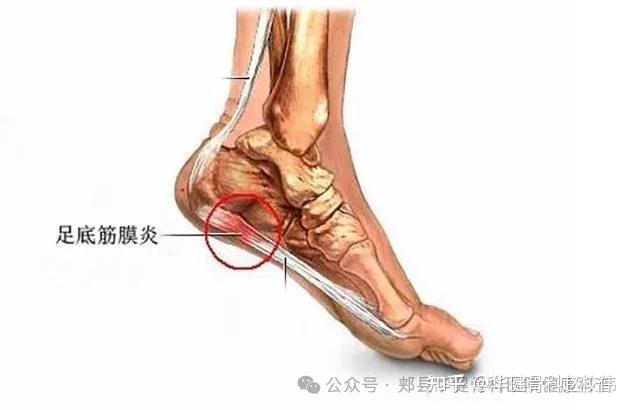 宝宝腿张大一点儿就不疼了吗宝宝腿张大一点儿是否会缓解疼痛