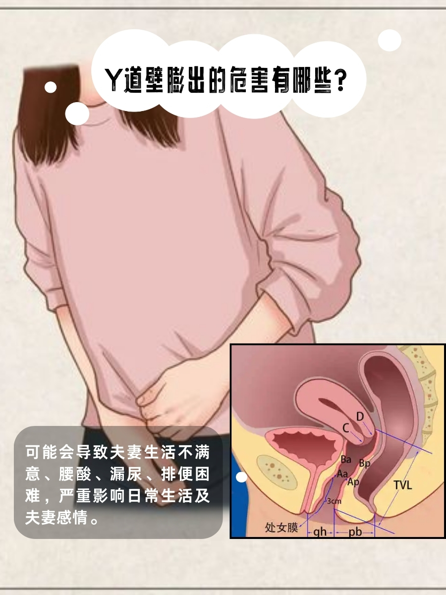 女性私处蹲下拍照有疙瘩女性三角毛毛区腹部疼痛-第3张图片