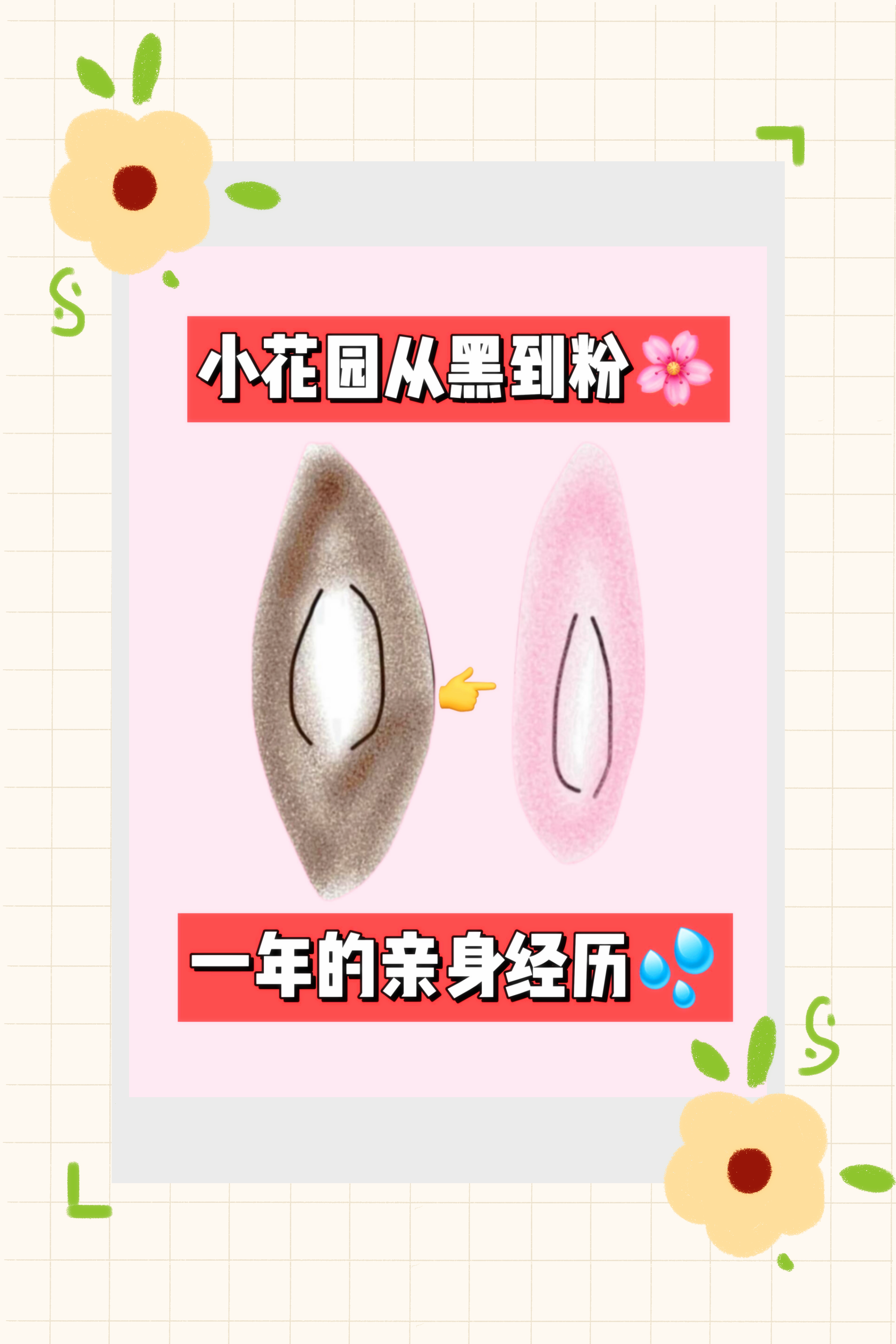 他趴在两腿中间添我私密有事吗他趴在两腿中间添我私密，是否有问题？