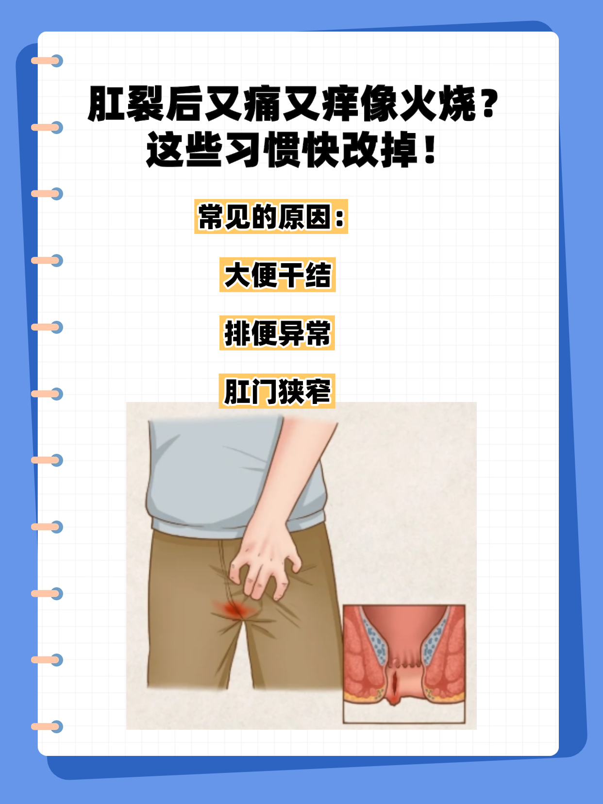 屁眼文化屁眼文化，探索其内涵与影响-第2张图片