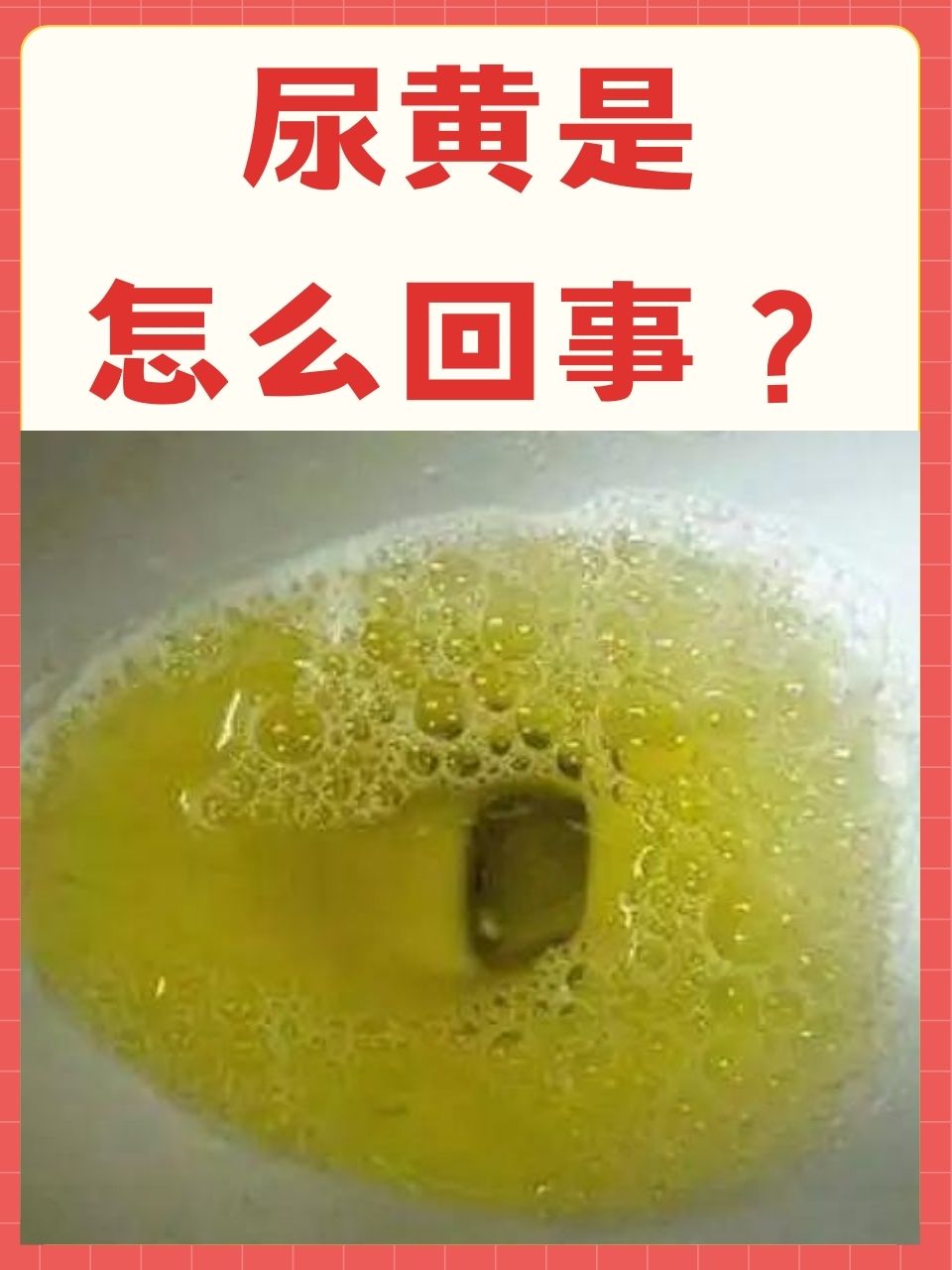 喝水不让尿还按压小腹玄喝水不让尿还按压小腹-第2张图片
