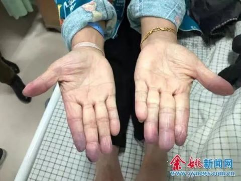 一晚上接了十几个人，疼痛难忍-第2张图片