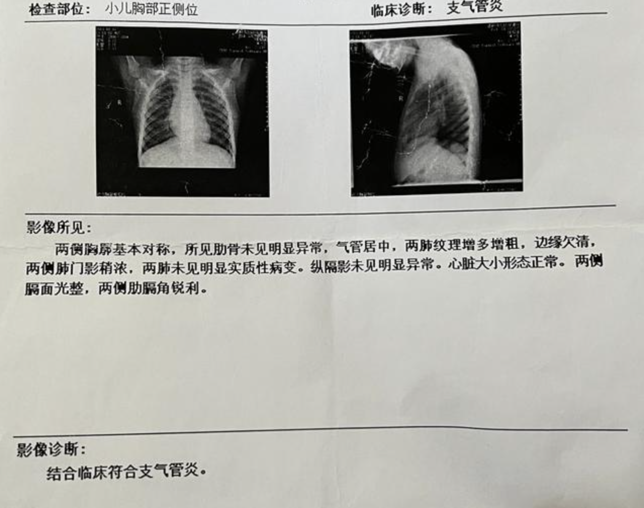 胸片100%曝光率软件胸片100%曝光，影像诊断的精准之选