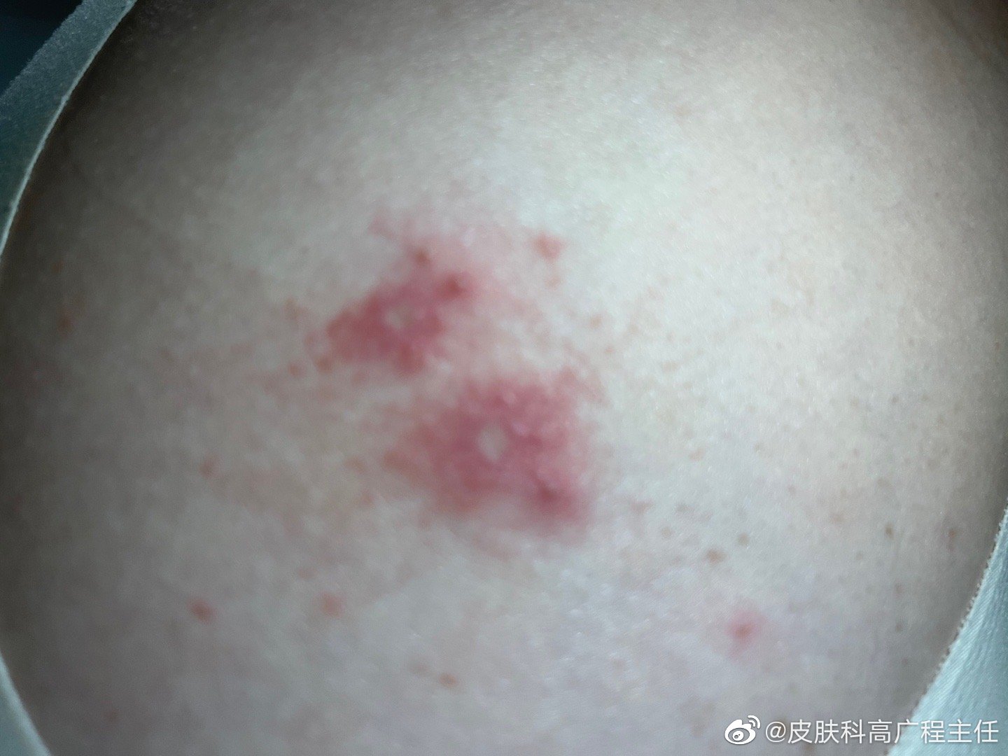 淑娟两腿间又痒了淑娟两腿间又痒了-第2张图片
