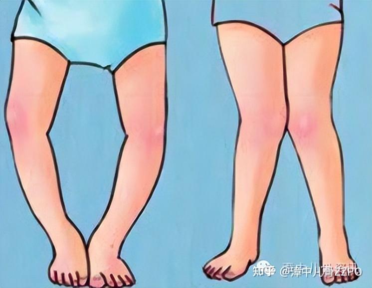 宝贝把腿张得大一点就不痛了宝贝把腿张得大一点就不痛了-第2张图片