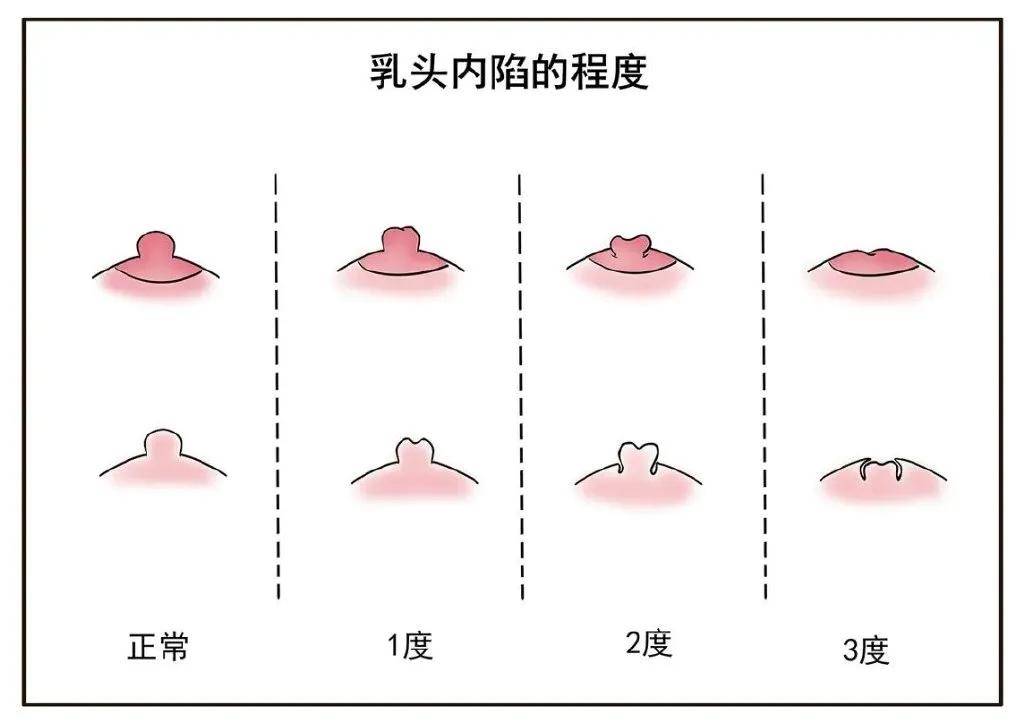美女扒胸露出奶头视频-第2张图片