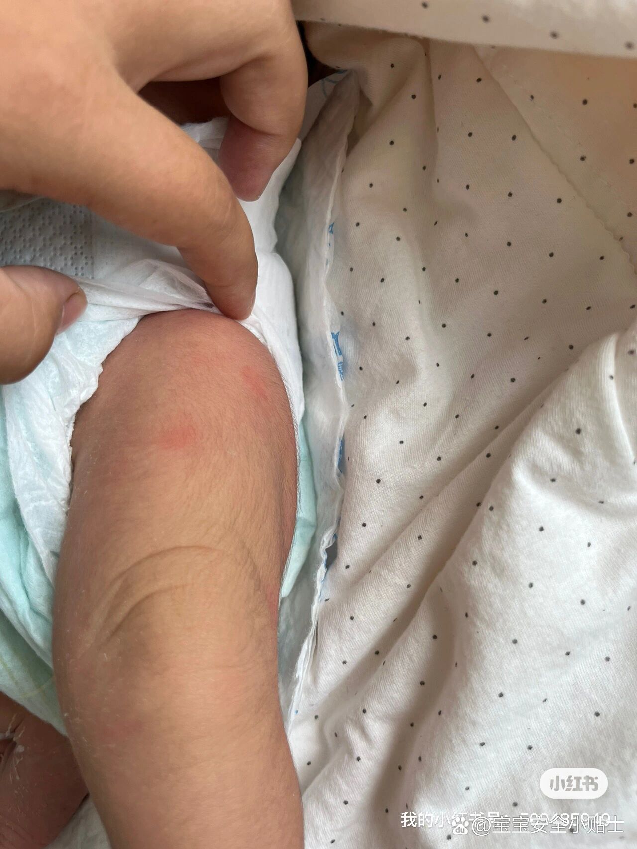 宝宝腿抬起来就不疼了怎么回事宝宝腿抬起来不再疼痛