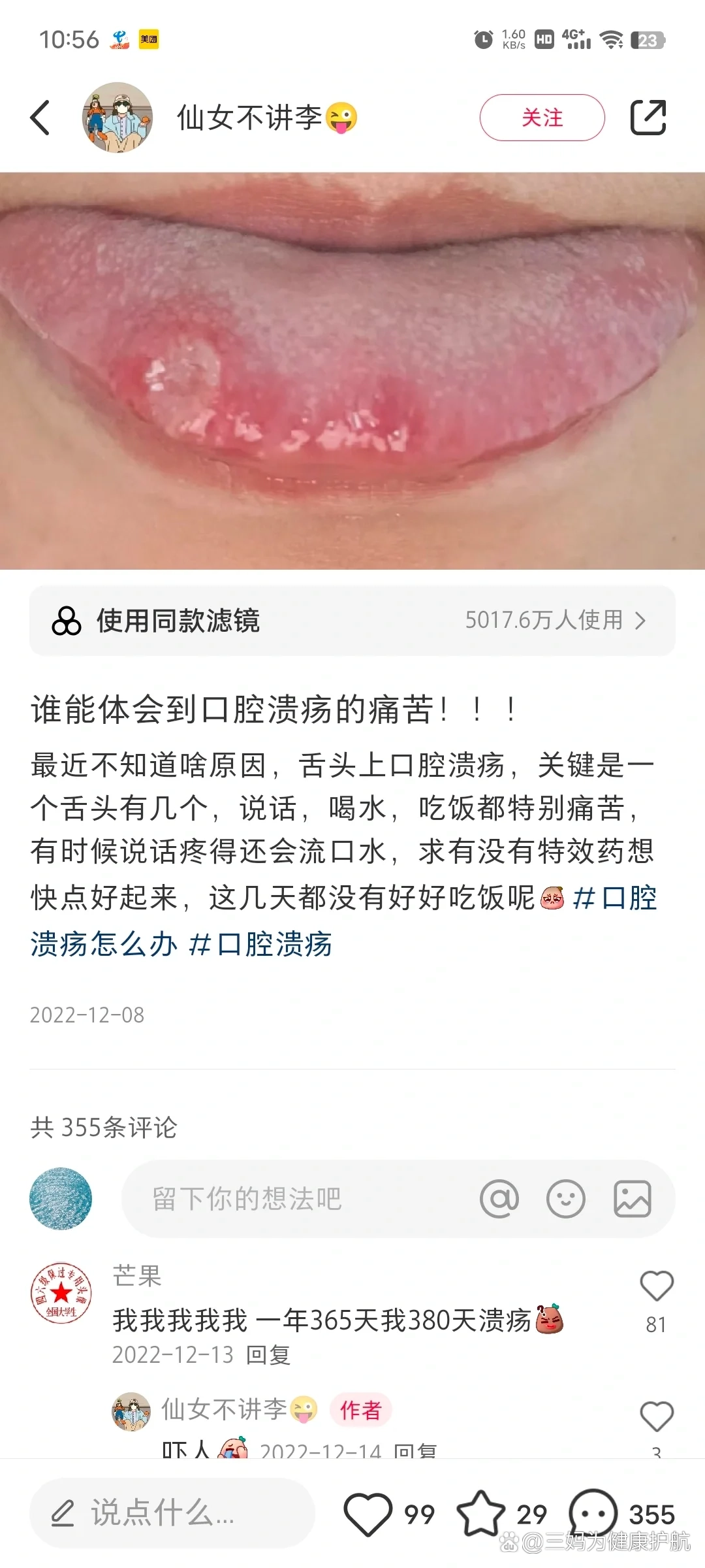 舌头往下舔到一个硬硬的包疼痛-第2张图片