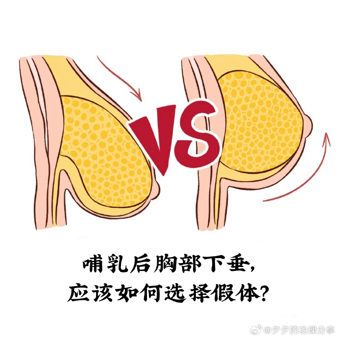 两个奶头被吃得又翘又痛两个奶头被吃得又翘又痛-第2张图片