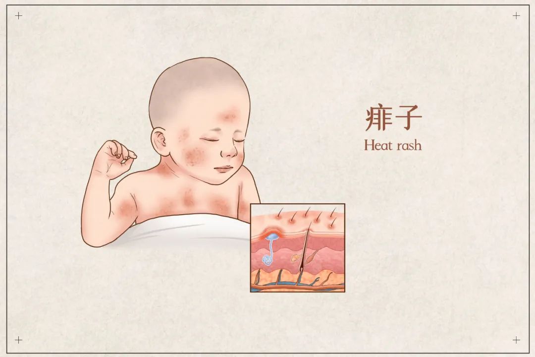宝宝湿成这样，还未开始就令人担忧-第3张图片