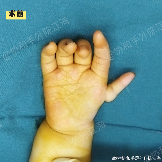 宝宝才两根手指就哭了怎么回事宝宝才两根手指就哭了