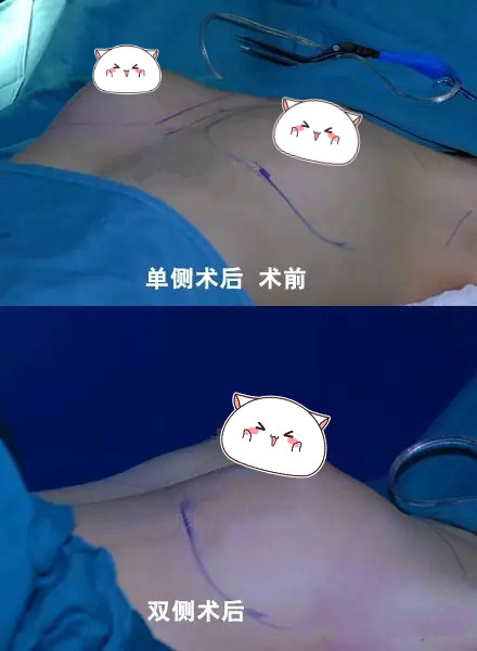 日本lachouchou丰胸膏效果怎么样日本Lachouchou丰胸膏，重塑自信的秘密武器-第2张图片
